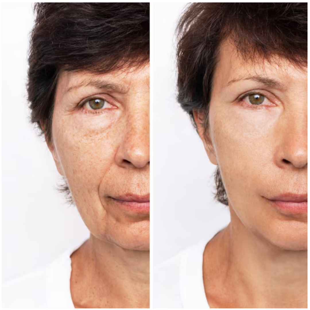 Crema Lifting Reafirmante Quita Arrugas en 60 segundos ✔️