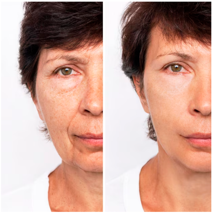 Crema Lifting Reafirmante Quita Arrugas en 60 segundos ✔️