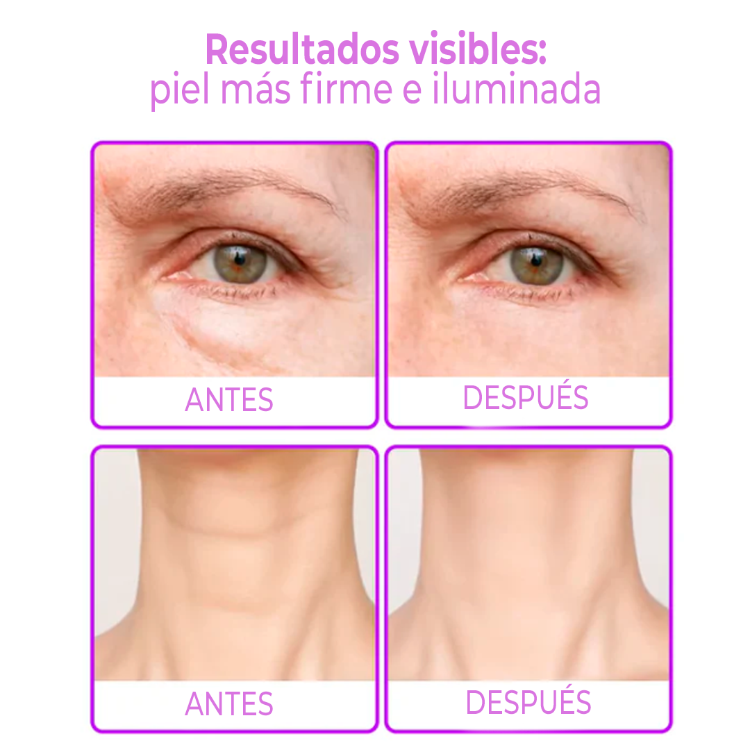 RejuMax – Combo Rejuvenecedor para Cuello y Ojos Que Aporta Firmeza y Suaviza Líneas, Devolviendo Juventud a la Piel