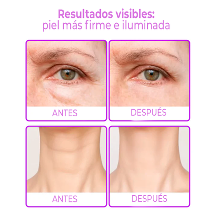 RejuMax – Combo Rejuvenecedor para Cuello y Ojos Que Aporta Firmeza y Suaviza Líneas, Devolviendo Juventud a la Piel