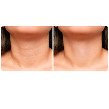 Crema Lifting Reafirmante Quita Arrugas en 60 segundos ✔️